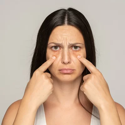 Worki pod oczami — przyczyna