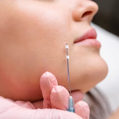 Nici liftingujące: jak długo utrzymuje się efekt?