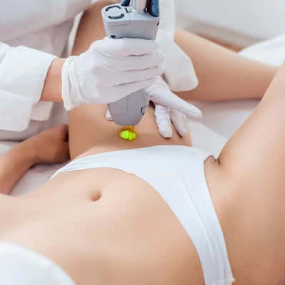 Depilacja okolic intymnych