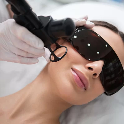 Laser frakcyjny — efekty