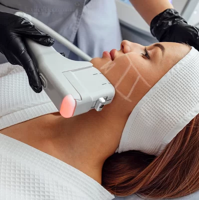 Zabieg HIFU — co to?