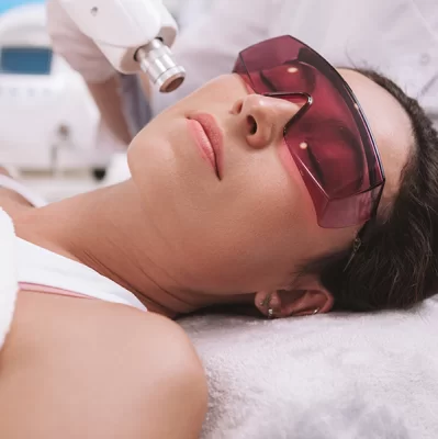 Laserowe usuwanie przebarwień efekty