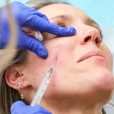 Co to jest kwas hialuronowy i jak działa na policzki?