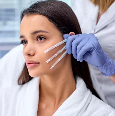 Co to są nici PDO i jak działają na bruzdy nosowo-wargowe?