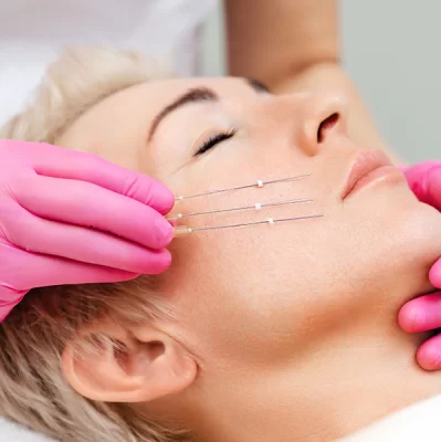 Czym są nici PDO i jak działają na opadające powieki?