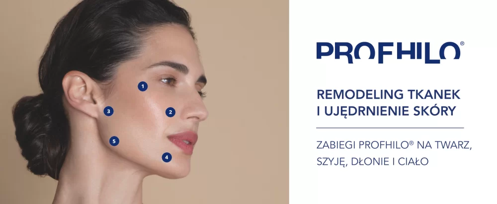 Profhilo wstrzykujemy w ściśle określone anatomiczne punkty