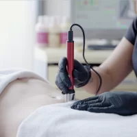Biolifting biustu BeautyTek - seria 6 zabiegów -10% - seria 10 zabiegów -20%