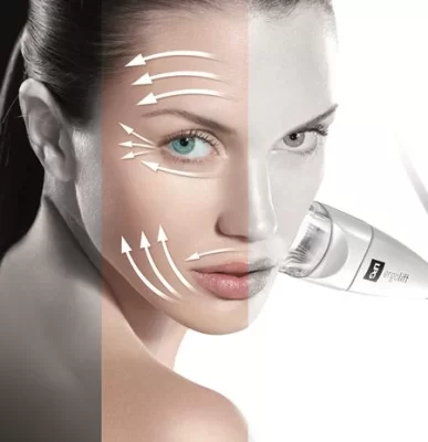 Endermologia Alliance twarz - Pakiet 6 zabiegów -13% - Pakiet 10 zabiegów -26% 