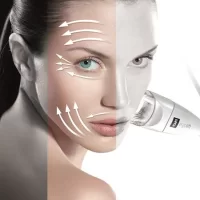 Endermologia Alliance twarz - Pakiet 6 zabiegów -13% - Pakiet 10 zabiegów -26% 
