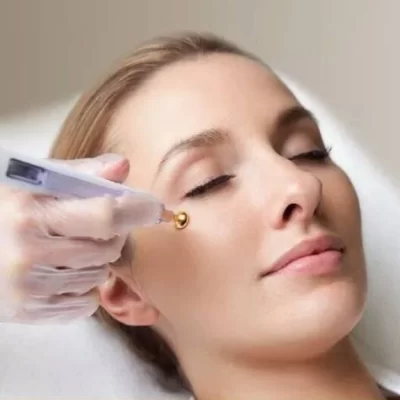 Pelleve -20% - Najmocniejszy lifting twarzy falami radiowymi