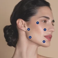 Profiloplastyka i bioremodeling twarzy -20%