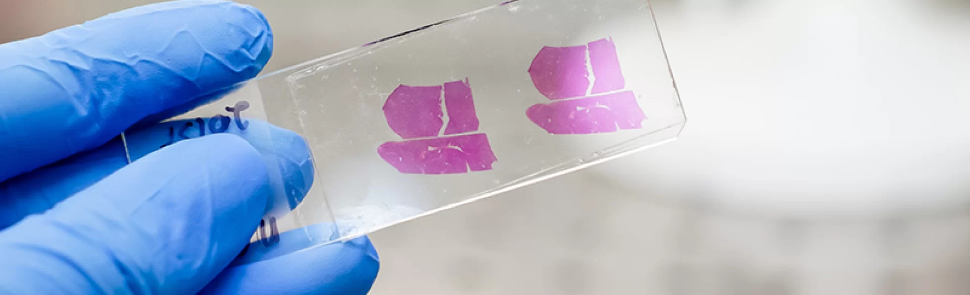 Badanie histopatologiczne