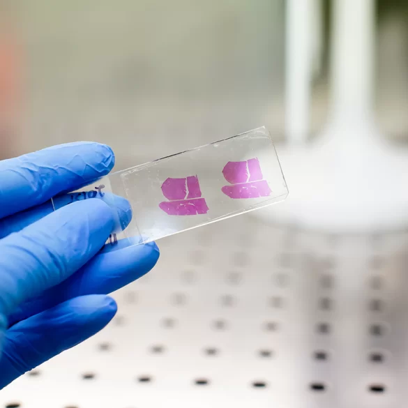 Badanie histopatologiczne