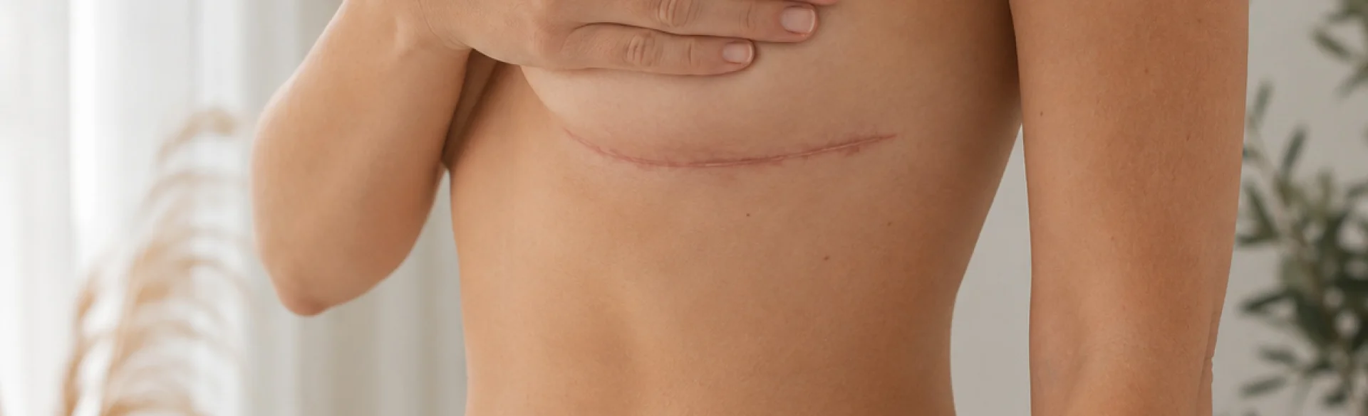 Blizna po implantach