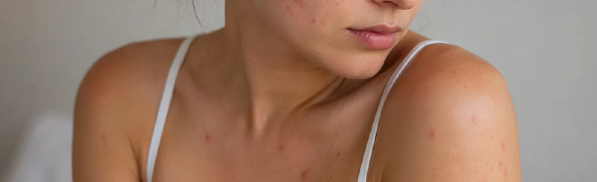 Czerwone krosty na ciele