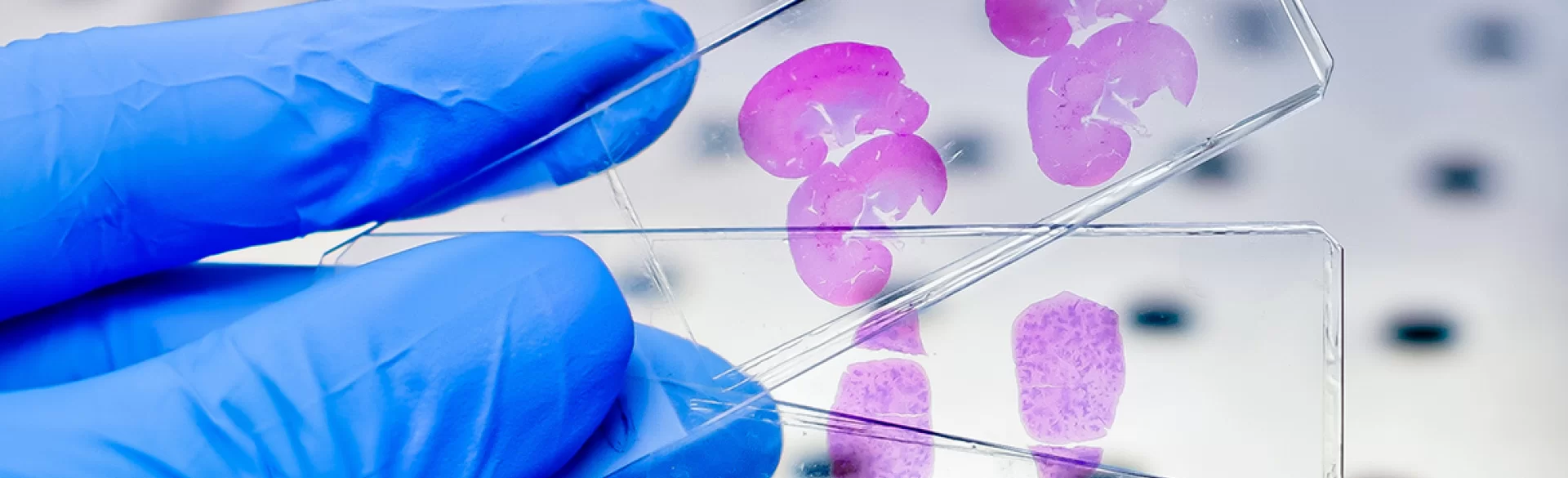 Długie oczekiwanie na wynik histopatologiczny