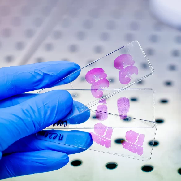 Długie oczekiwanie na wynik histopatologiczny