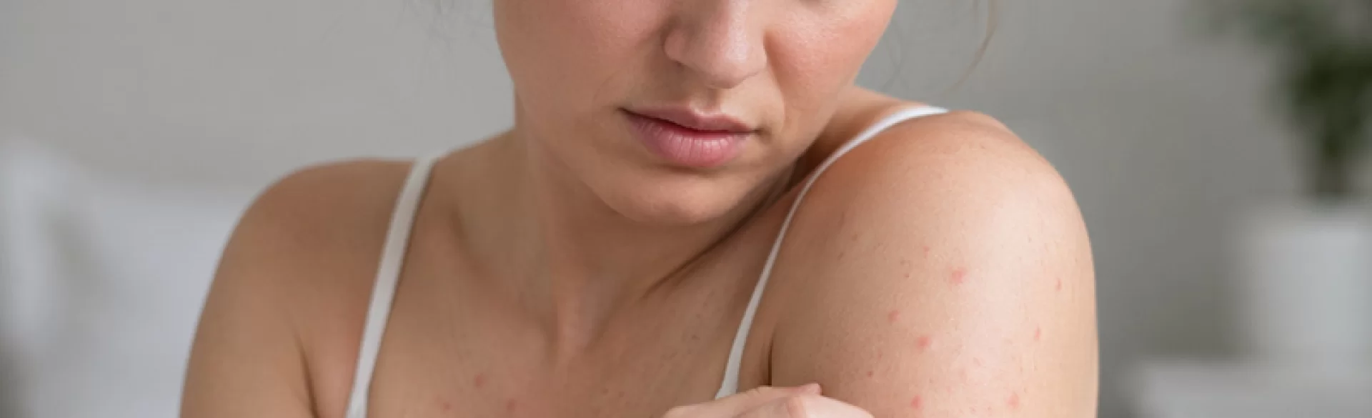 Krosty swędzące na ciele