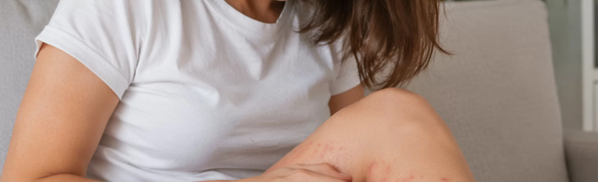 Krosty swędzące na nogach