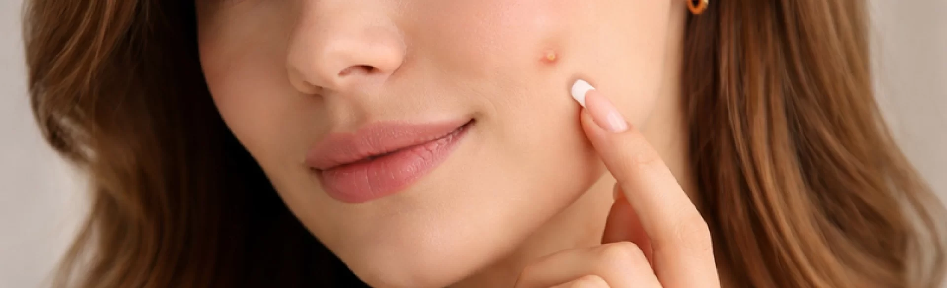 Krosty z białym czubkiem