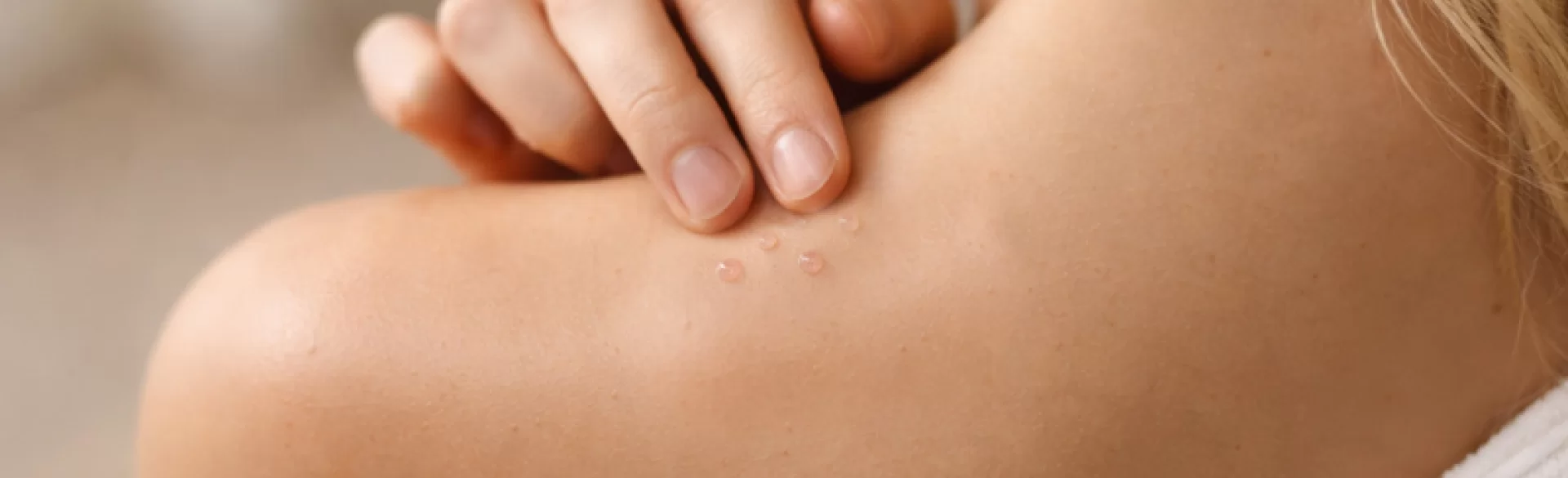 Krosty z płynem surowiczym