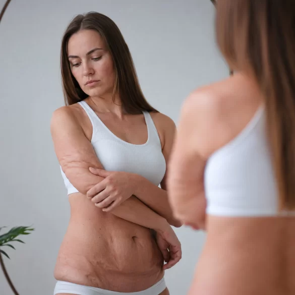 Lipodystrofia