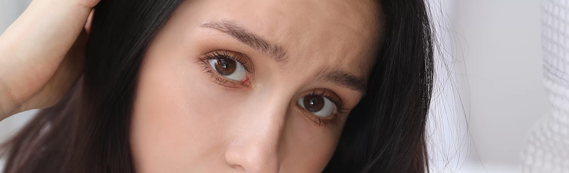 Łupież łojotokowy