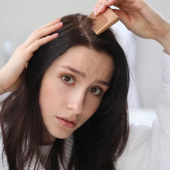 Łupież łojotokowy