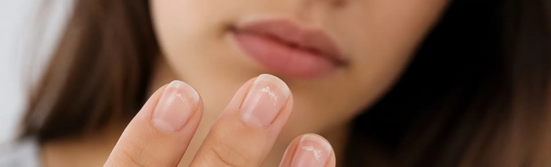 Pękające paznokcie