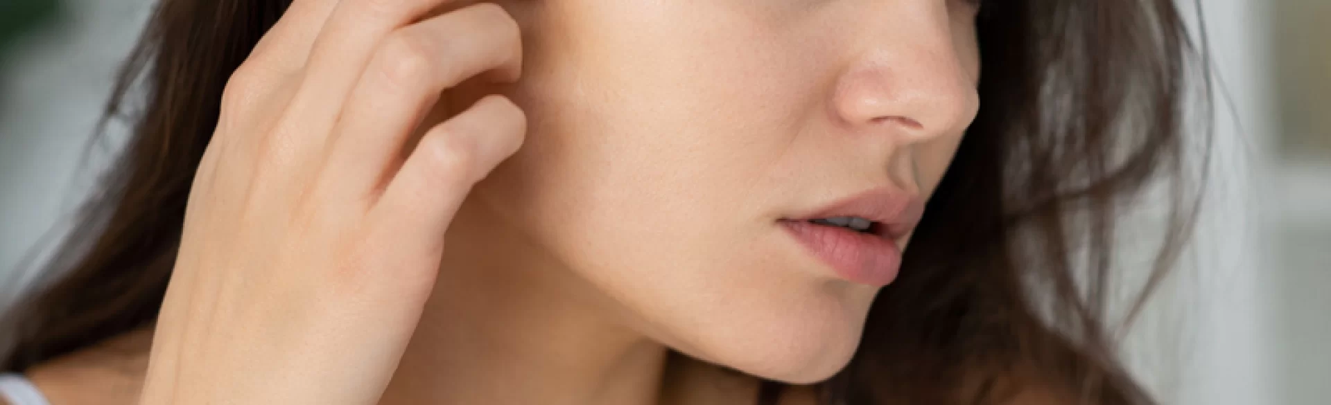 Pryszcze na skroniach