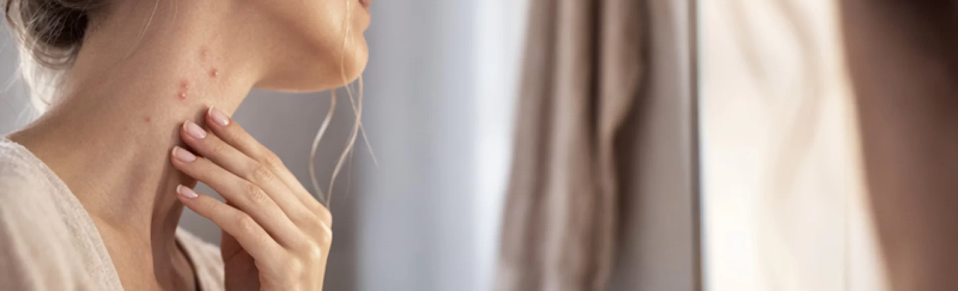 Ropne pryszcze na szyi