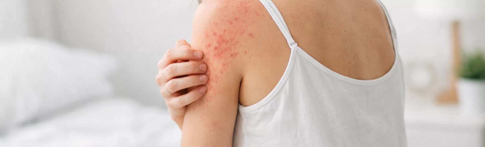 Swędzące krosty na ciele