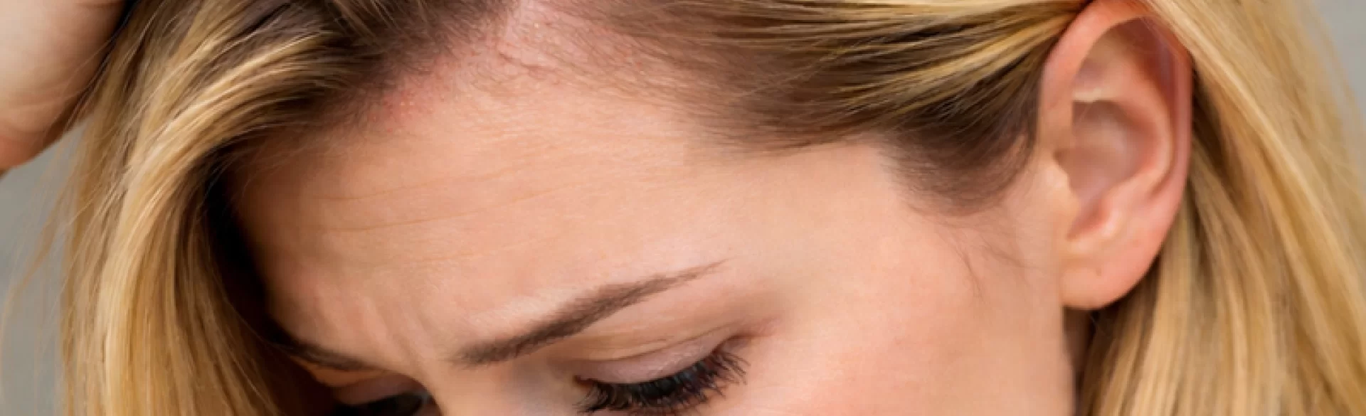 Żółte pryszcze na głowie