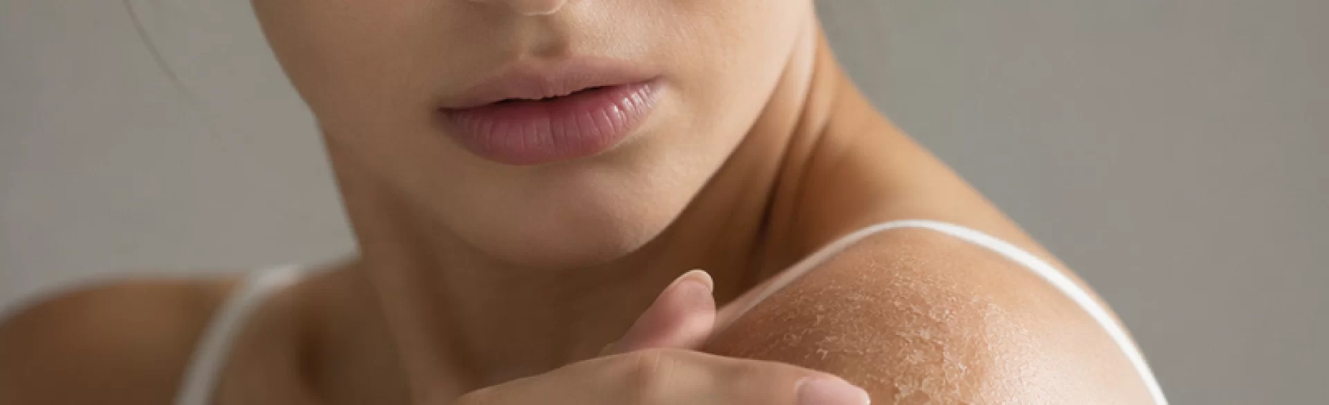 Zrogowacenia na skórze