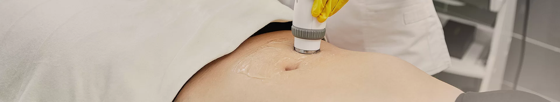 Usuwanie rozstępów po ciąży