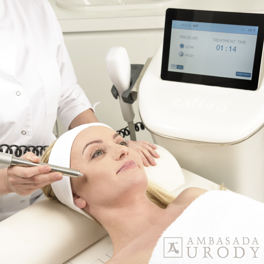 Termolifting Zaffiro — wszystko, co chcesz wiedzieć Blog Ambasada